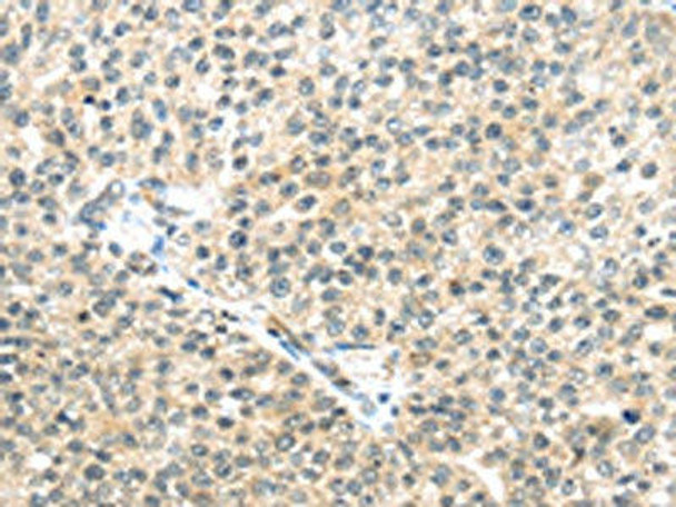 TTBK2 Antibody PACO20784