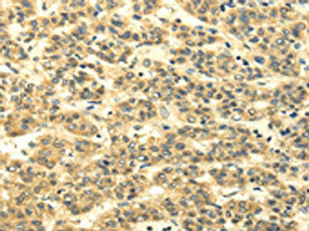 MSI1 Antibody PACO20824