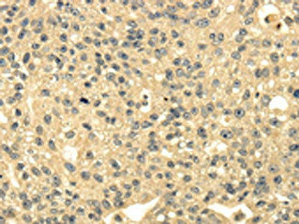 MSI1 Antibody PACO20824