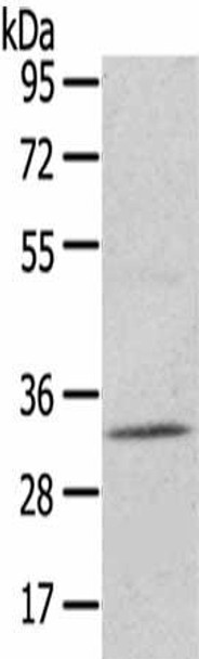 UPP2 Antibody PACO20838