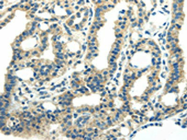 PDPN Antibody PACO20912