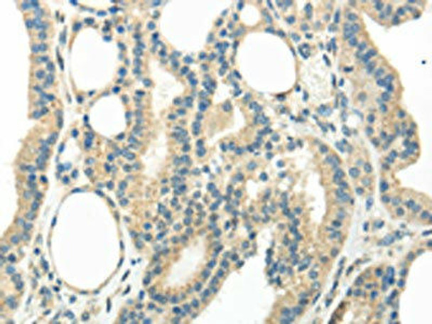 WNT6 Antibody PACO20918