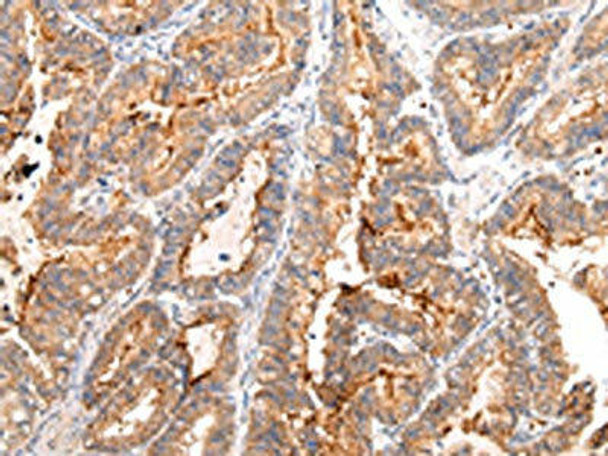 MUC1 Antibody PACO20982
