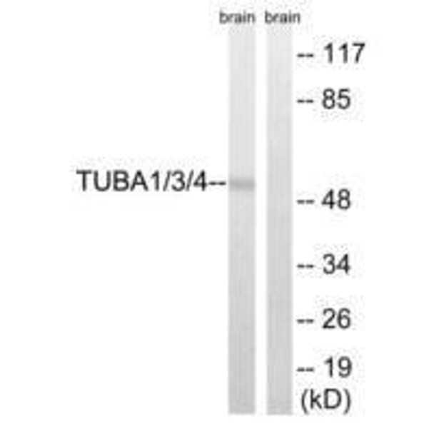 TUBA1A/TUBA1B/TUBA1C/TUBA3C/TUBA3E/TUBA4A Ab-272 Antibody PACO21639
