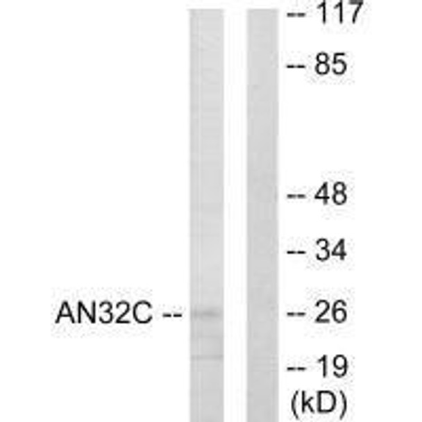 ANP32C Antibody PACO21686