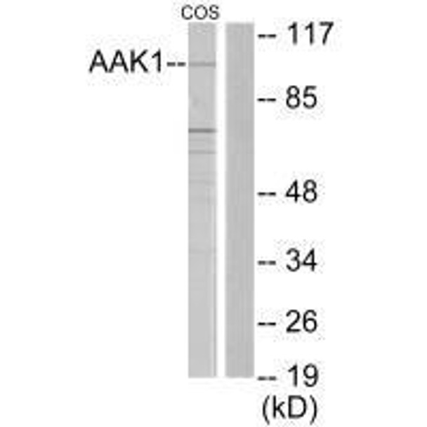 AAK1 Antibody PACO21868