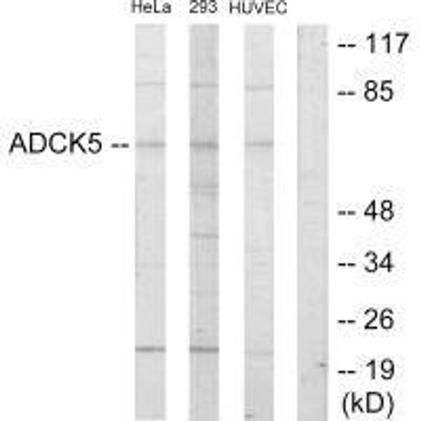 ADCK5 Antibody PACO21870