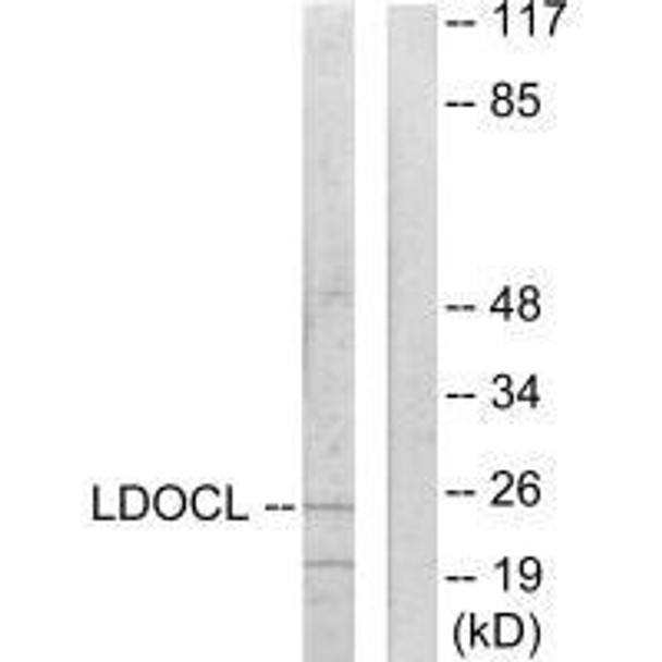 LDOC1L Antibody PACO21879