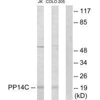 PPP1R14C Antibody PACO21902