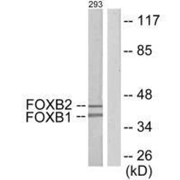 FOXB1/FOXB2 Antibody PACO21934