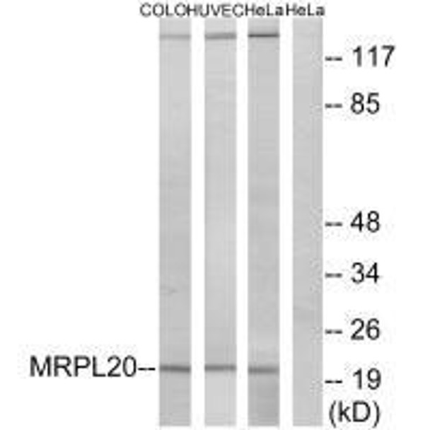 MRPL20 Antibody PACO22089