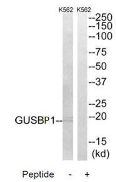 GUSBP1 Antibody PACO22203