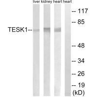 TESK1 Antibody PACO22317