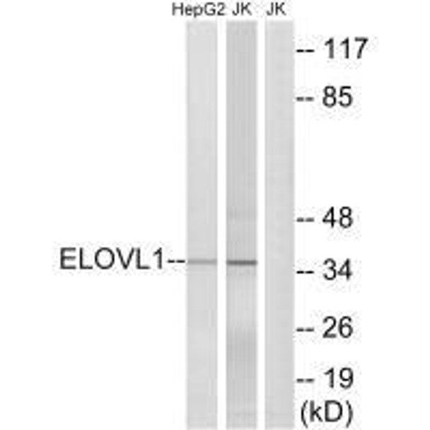 ELOVL1 Antibody PACO22323