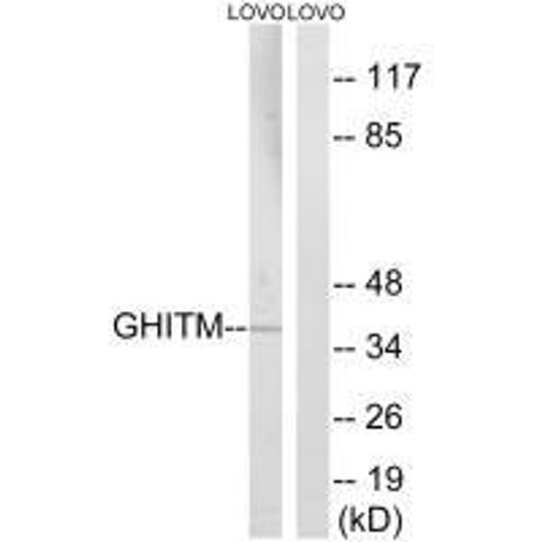 GHITM Antibody PACO22352