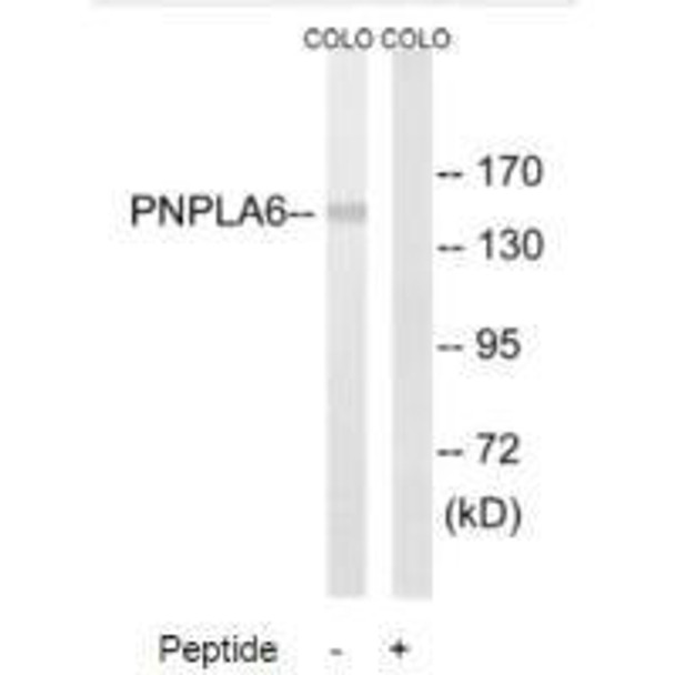 PNPLA6 Antibody PACO22471