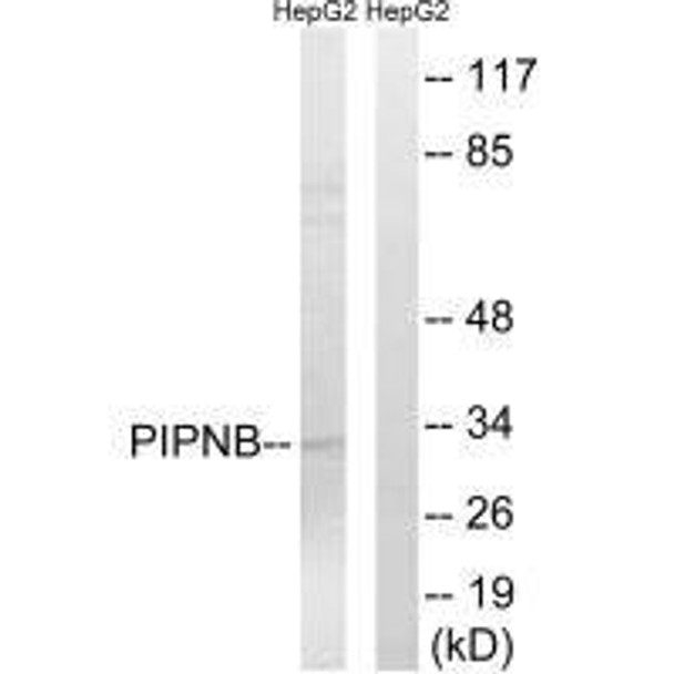 PITPNB Antibody PACO22500