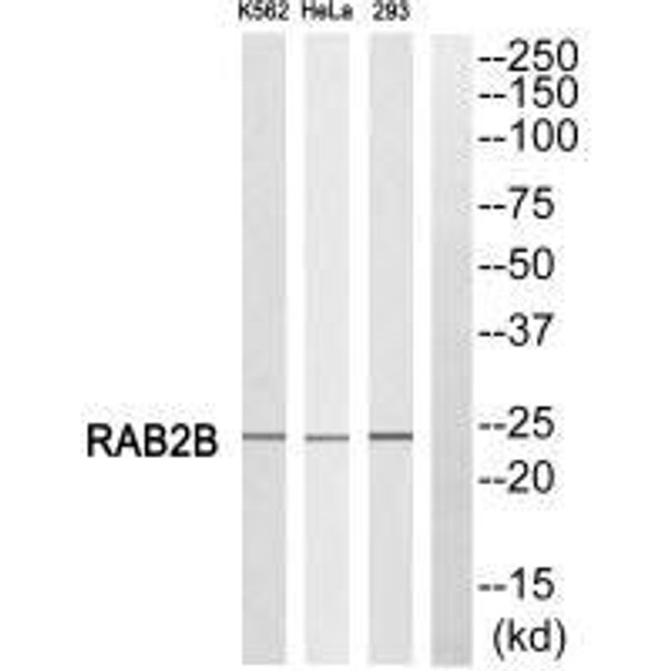 RAB2B Antibody PACO22553