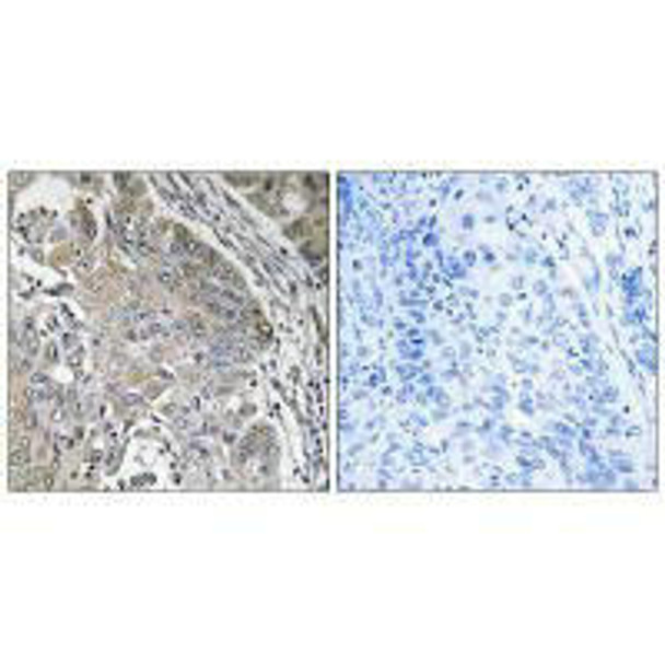 SPINK6 Antibody PACO22592