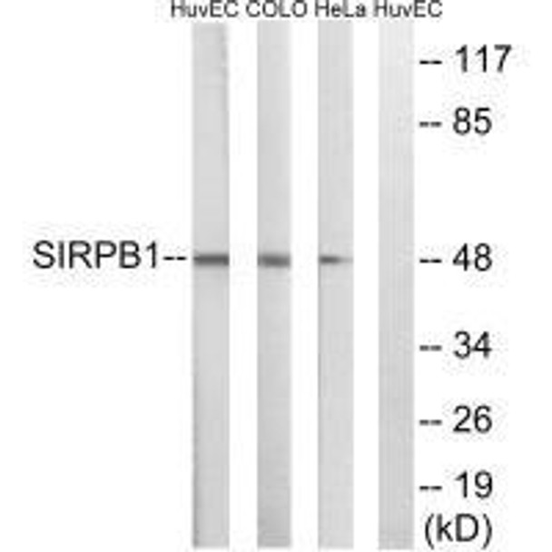 SIRPB1 Antibody PACO22613