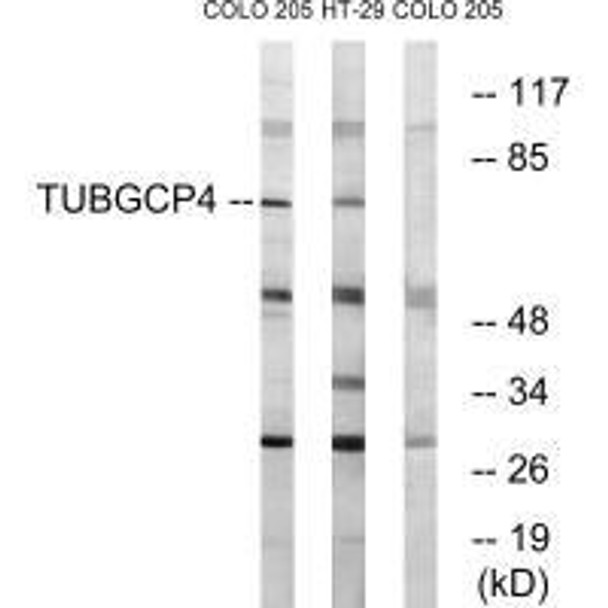 TUBGCP4 Antibody PACO22633