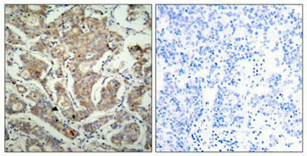 Bad Ab-155 Antibody PACO22894