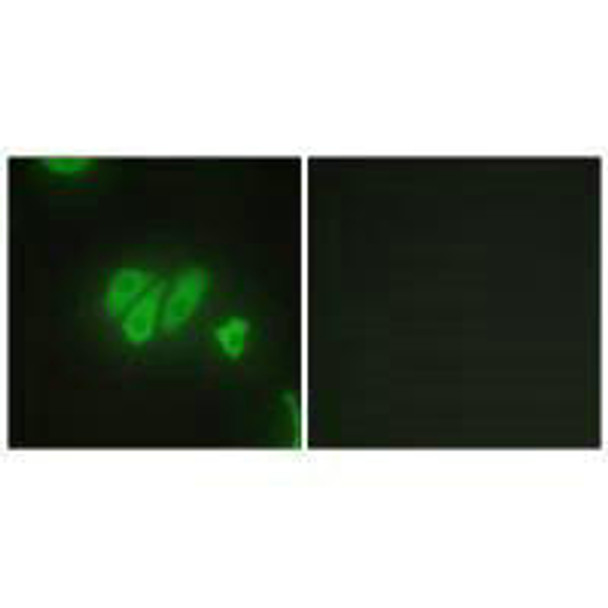 PDZD2 Antibody PACO23166