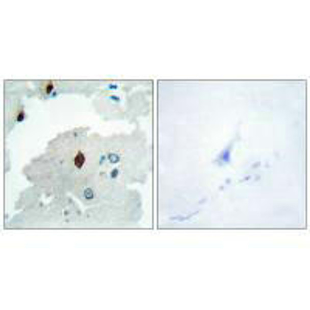 PTTG1IP Antibody PACO23232