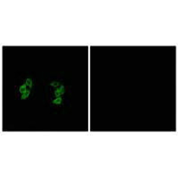 CSNK1A1L/CSNK1A1 Antibody PACO23264
