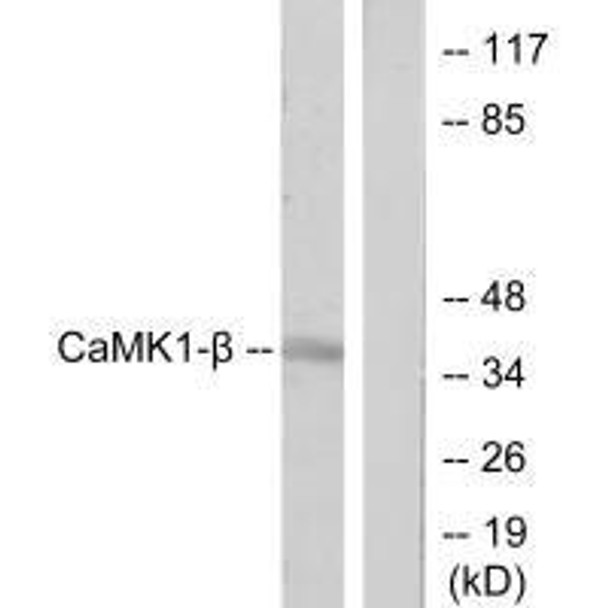 PNCK Antibody PACO23355