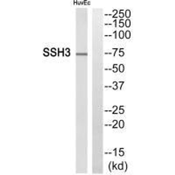 SSH3 Antibody PACO23466