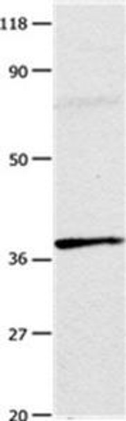 ADORA3 Antibody PACO23513