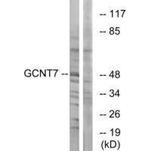 GCNT7 Antibody PACO23796