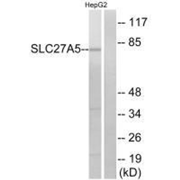 SLC27A5 Antibody PACO23797