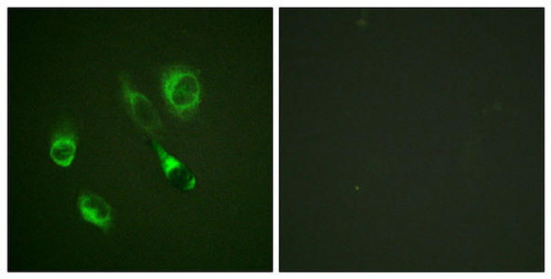 Phospho-EPHA2/EPHA3/EPHA4 Tyr588/596 Antibody PACO24381