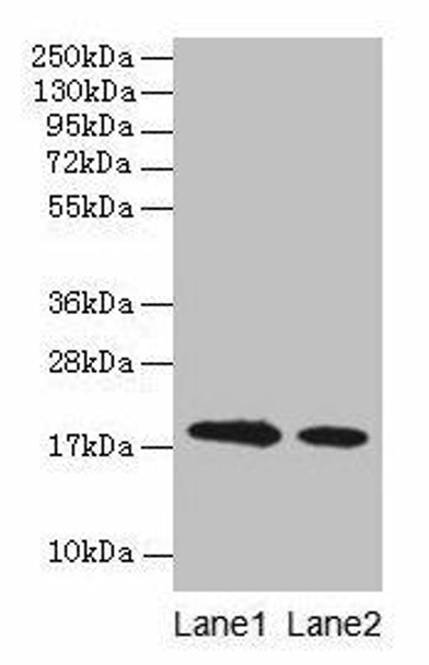 LGB Antibody PACO25284