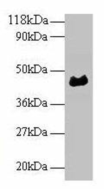 alpha-1-acidglycoprotein Antibody PACO25316