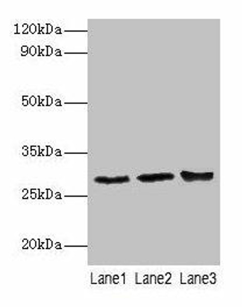 Ca1 Antibody PACO25432