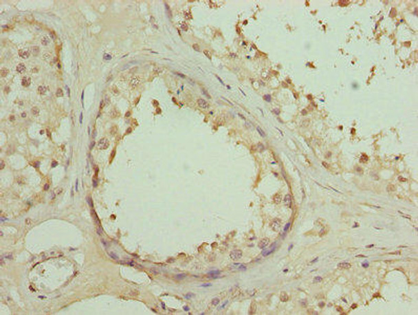 DSCR9 Antibody PACO26333