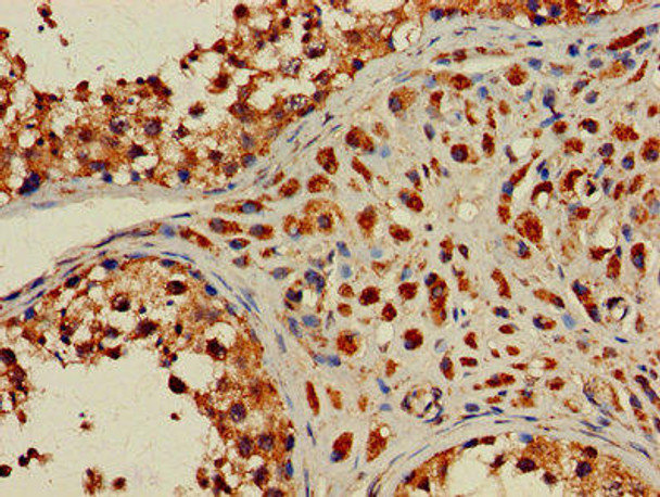 HIST2H2AC Antibody PACO27377