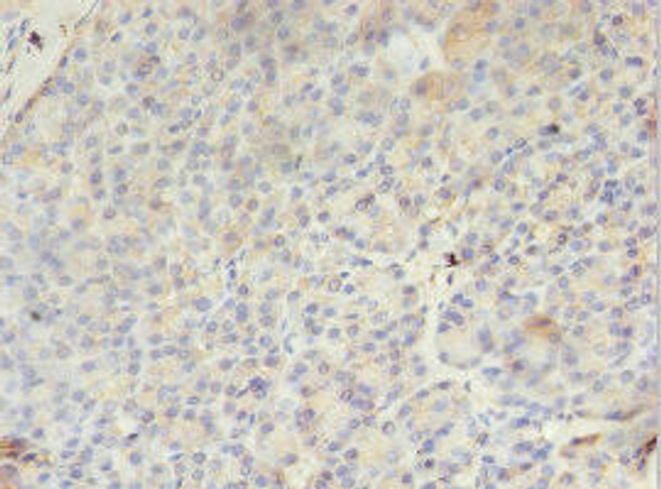 PMM1 Antibody PACO29022