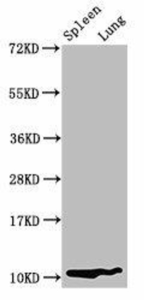 S100a8 Antibody PACO29712