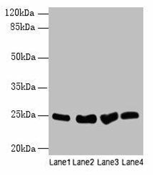 Socs3 Antibody PACO30064