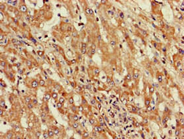 ST8SIA5 Antibody PACO30158