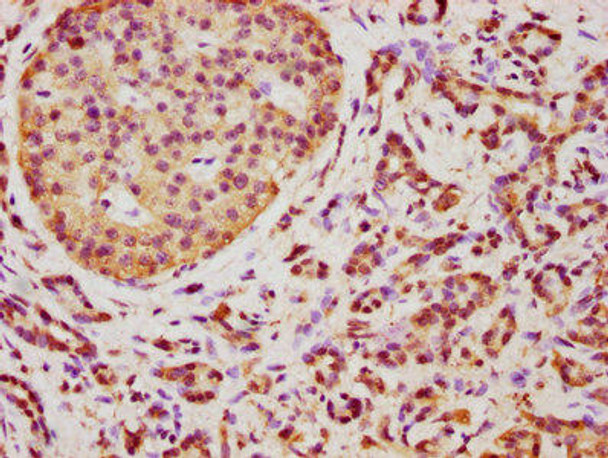 TMEM14A Antibody PACO30486