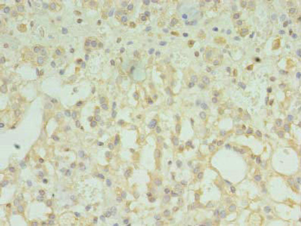 TMEM33 Antibody PACO30586