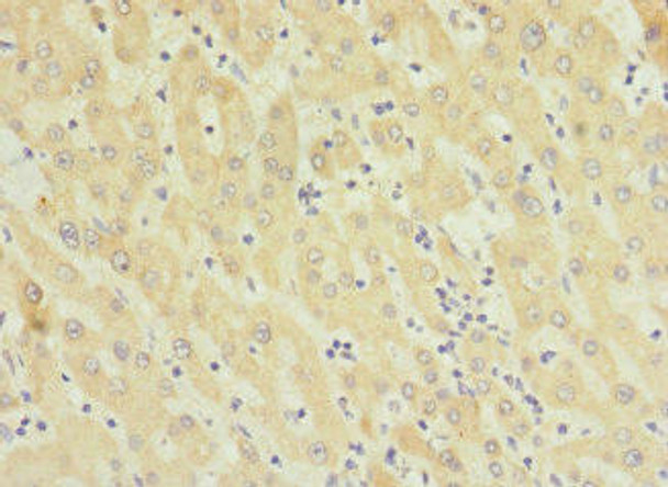 TMEM91 Antibody PACO30658