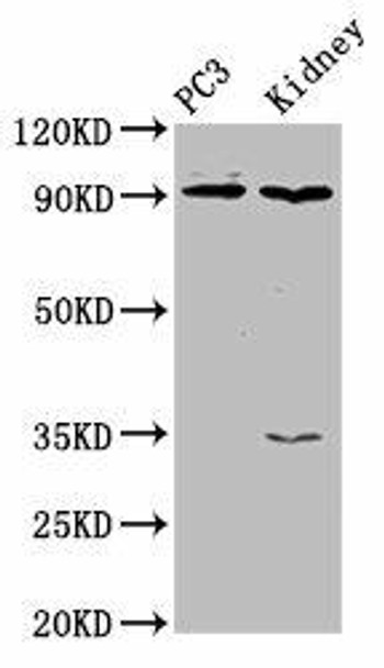 CDK11A Antibody PACO31932