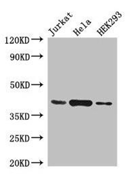 HLA-C Antibody PACO33564