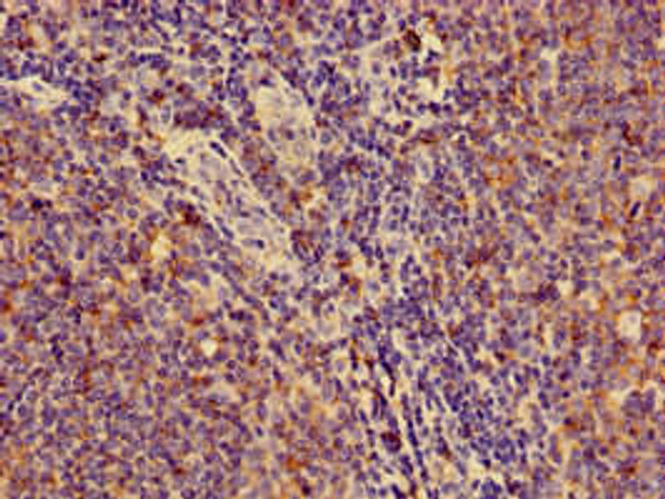 HLA-C Antibody PACO33564